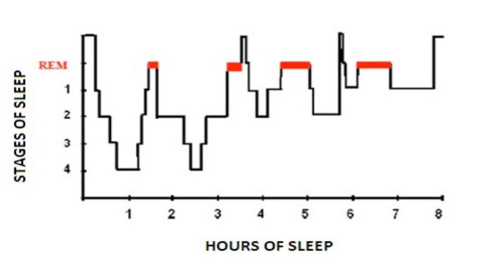 Sleep Hypnogram