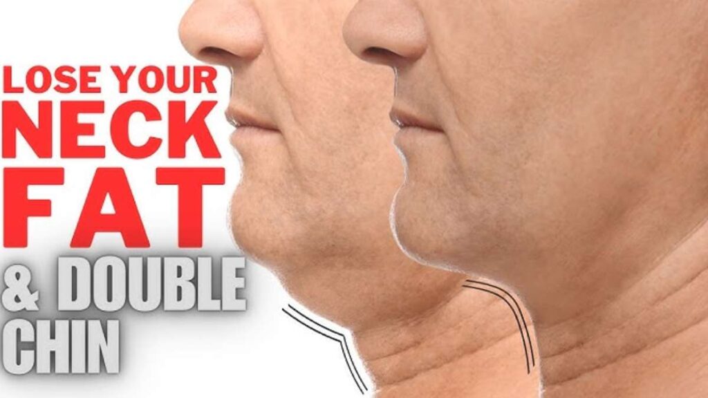 does your head shrink when you lose weight